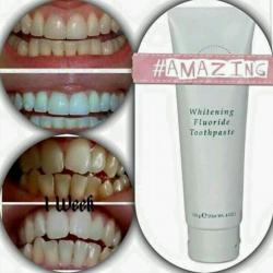 Want whiter teeth without the price tag???